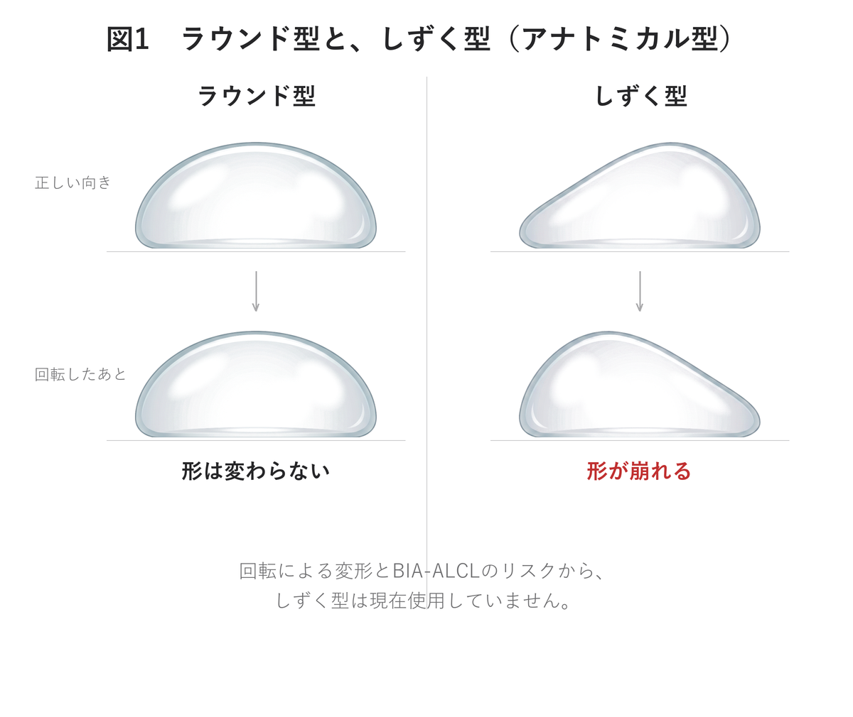 豊胸インプラントのラウンド型としずく型(アナトミカル型)の違い|UNE美容外科