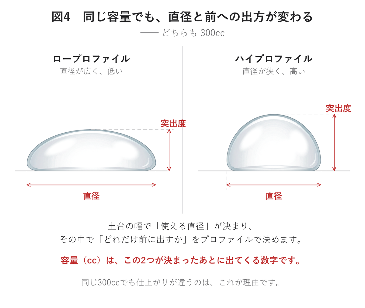 同じ容量でもプロファイル(突出度)で直径と前への出方が変わる|UNE美容外科
