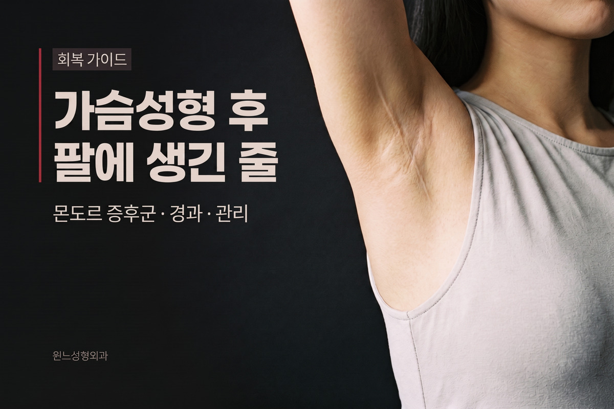 가슴성형 후 팔에 줄이 생겼다면, 몬도르병일까